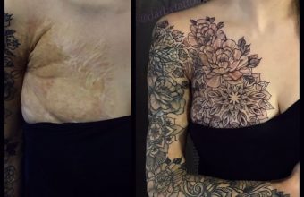 татуировка скрывающая шрам